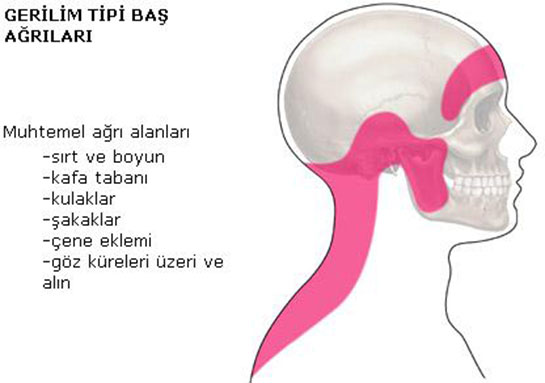 Gerilim Tipi Ba Ars
